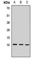 EIF1AX Rabbit Polyclonal Antibody