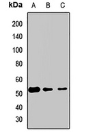 eTF1 Rabbit Polyclonal Antibody