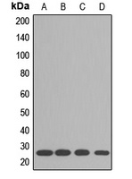 RPL10A Rabbit Polyclonal Antibody