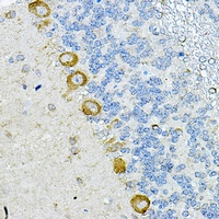 RPL10A Rabbit Polyclonal Antibody