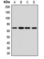 CPSF6 Rabbit Polyclonal Antibody
