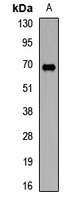 TRMT2A Rabbit Polyclonal Antibody
