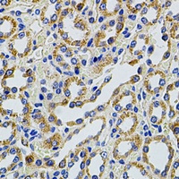 TRMT2A Rabbit Polyclonal Antibody
