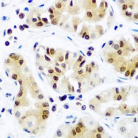 eIF2C2 Rabbit Polyclonal Antibody