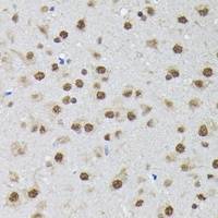 PTBP2 Rabbit Polyclonal Antibody