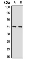 SNRNP70 Rabbit Polyclonal Antibody