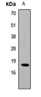 CIRBP Rabbit Polyclonal Antibody