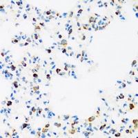 FMR1 Rabbit Polyclonal Antibody