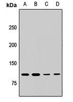 MLL5 Rabbit Polyclonal Antibody