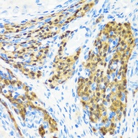 MLL5 Rabbit Polyclonal Antibody