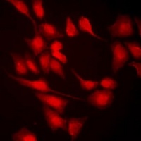 MLL5 Rabbit Polyclonal Antibody