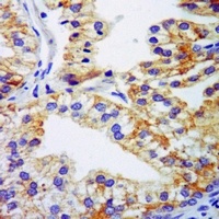 TSSC3 Rabbit Polyclonal Antibody