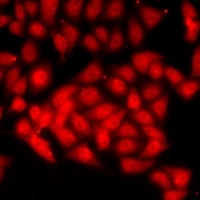 CAF-I p60 Antibody
