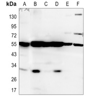 BNIP3L Rabbit Polyclonal Antibody