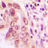 BNIP3L Rabbit Polyclonal Antibody