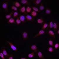 PRDM14 Rabbit Polyclonal Antibody