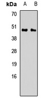 CALU Rabbit Polyclonal Antibody
