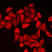 CALU Rabbit Polyclonal Antibody