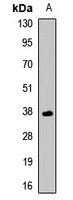 LECT1 Rabbit Polyclonal Antibody