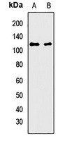 AIP2 Rabbit Polyclonal Antibody