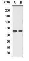 MUS81 Rabbit Polyclonal Antibody