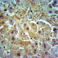Collagen 10 alpha 1 Rabbit Polyclonal Antibody