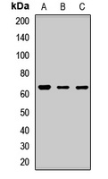 CRY2 Rabbit Polyclonal Antibody