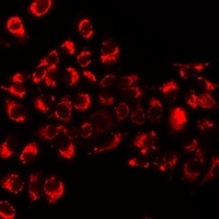 GIF Rabbit Polyclonal Antibody