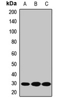 HPGD Rabbit Polyclonal Antibody