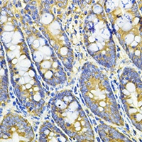HPGD Rabbit Polyclonal Antibody