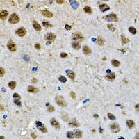 Cyclophilin D Rabbit Polyclonal Antibody