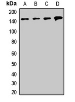 SMC1A Rabbit Polyclonal Antibody