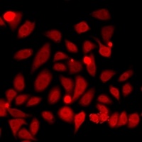 SMC1A Rabbit Polyclonal Antibody