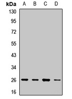 ARD1 Rabbit Polyclonal Antibody