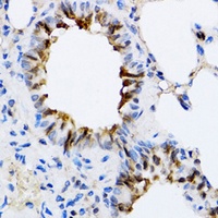 ARD1 Rabbit Polyclonal Antibody