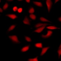 ARD1 Rabbit Polyclonal Antibody