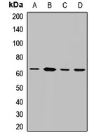 DYRK2 Rabbit Polyclonal Antibody