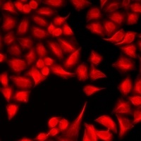 DYRK2 Rabbit Polyclonal Antibody
