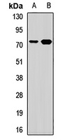 TRMT2A Rabbit Polyclonal Antibody