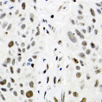 TRMT2A Rabbit Polyclonal Antibody