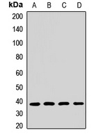 NDUFAF5 Rabbit Polyclonal Antibody