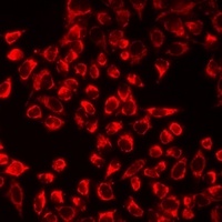 TPH2 Rabbit Polyclonal Antibody
