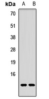 p53 AIP1 Rabbit Polyclonal Antibody