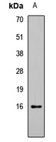 Histone H3 (Acetyl-K27) Antibody