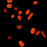 Histone H3 (Acetyl-K27) Antibody