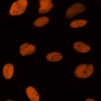 Histone H3 (Acetyl-K14) Antibody