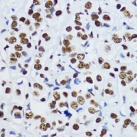 Histone H3 (Acetyl-K9) Antibody
