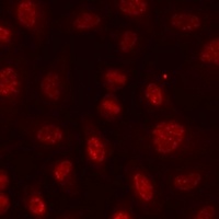 Histone H3 (Acetyl-K9) Antibody