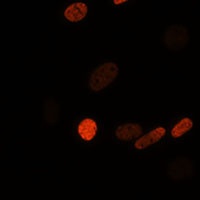 Histone H3 (Acetyl-K56) Antibody