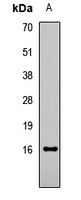 Histone H3 (Acetyl-K18) Antibody